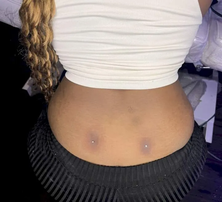 Back Dermal Piercings: Beauty and Risks of Back Dimple Piercings